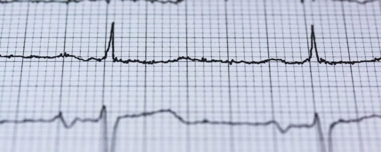 Pension Transfers and Serious Ill Health Lump Sums